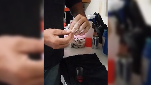 Il perce et boit le liquide de ses ampoules aux doigts