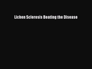 Download Books Lichen Sclerosis Beating the Disease E-Book Download