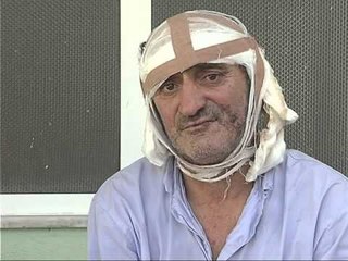 GREVA E URISE PA ZGJIDHJE NE DITEN E 31 SHTOHEN KOMPLIKACIONET E GREVISTEVE LAJM