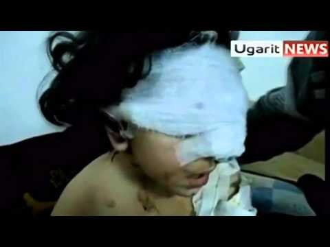 MASAKRA NE SIRI RRETH 100 TE VRARE NE QYTETIN E HOMS NGA LUFTIMET LAJM