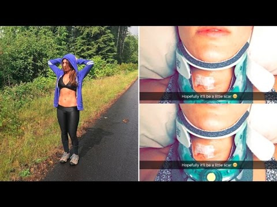 Nikki Bella's post-surgery road to recovery