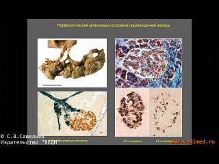 С. В. Савельев - Диабет I типа