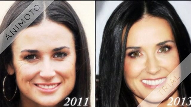 Get nice staring at dermis on this modern day!