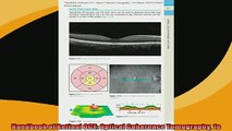 READ book  Handbook of Retinal OCT Optical Coherence Tomography 1e  BOOK ONLINE