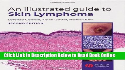 Read An Illustrated Guide to Skin Lymphoma  Ebook Online