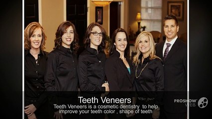 Teeth Veneers Greenville