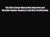 Read The ECG in Acute Myocardial Infarction and Unstable Angina: Diagnosis and Risk Stratification