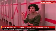 Ünlü Yıldız, Estetik Operasyonlardan Sonra Tanınmaz Hale Geldi