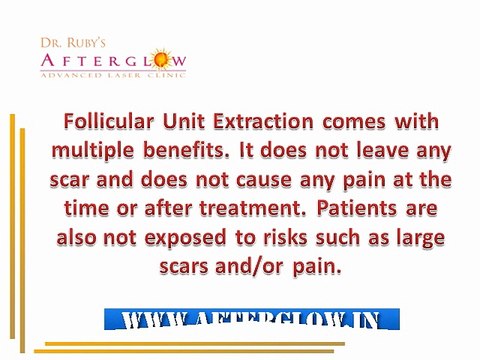 Understand the Advantages of FUE Hair Transplant