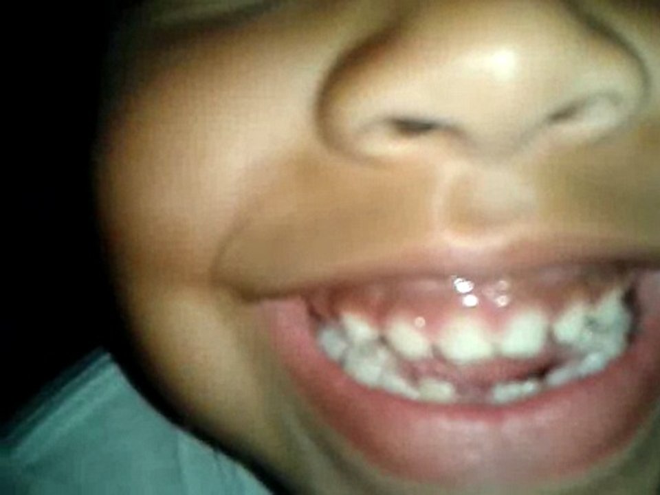 El diente de serrucho de mi sarita