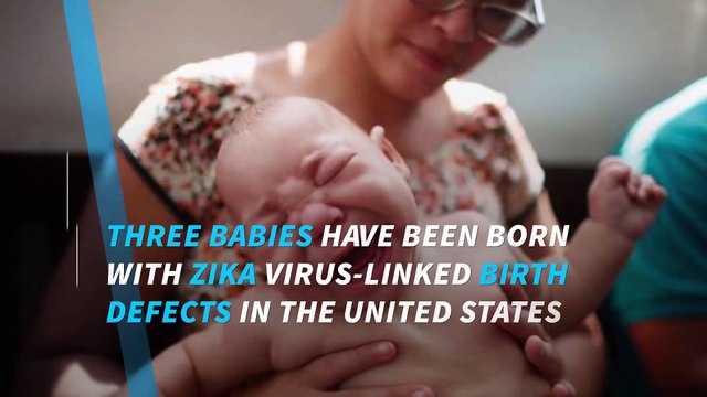 6 cases of birth defects caused by Zika reported in US