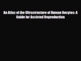 Read An Atlas of the Ultrastructure of Human Oocytes: A Guide for Assisted Reproduction PDF