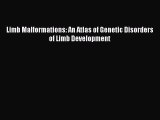 Read Limb Malformations: An Atlas of Genetic Disorders of Limb Development PDF Full Ebook