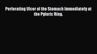 Download Perforating Ulcer of the Stomach Immediately at the Pyloric Ring. PDF Online