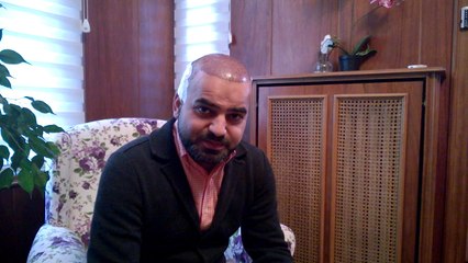 Hair Transplant Abroad WA Patient from UK