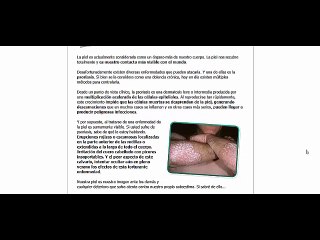 como curar la psoriasis con un remedio super eficaz y comprobado