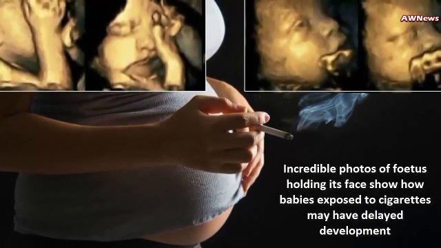 Вот что происходит с плодом в утробе, если мама курит во время беременности. Жуткие кадры!