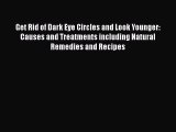 Read Books Get Rid of Dark Eye Circles and Look Younger: Causes and Treatments including Natural