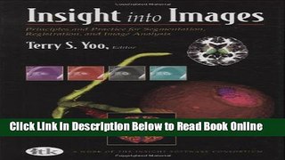 Read Insight into Images: Principles and Practice for Segmentation, Registration, and Image