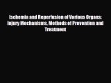 Read Ischemia and Reperfusion of Various Organs: Injury Mechanisms Methods of Prevention and