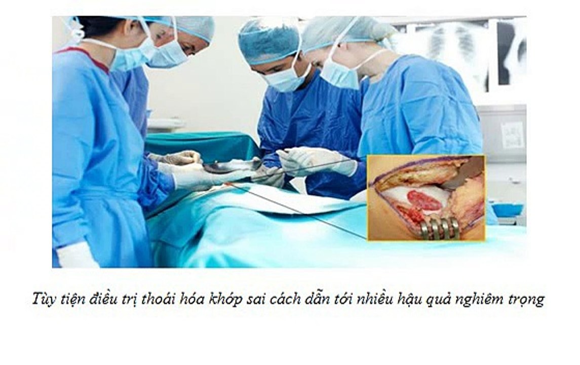 Thuốc giảm đau nhức xương khớp và tác dụng phụ