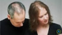 Over 6 Million Women And Men Lose Their Hair