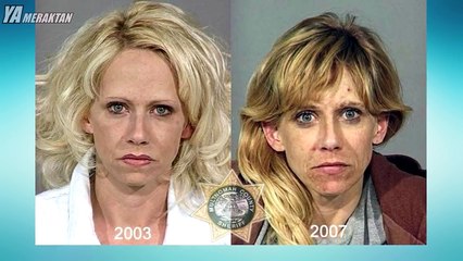 Uyuşturucu Kullananların Son halleri