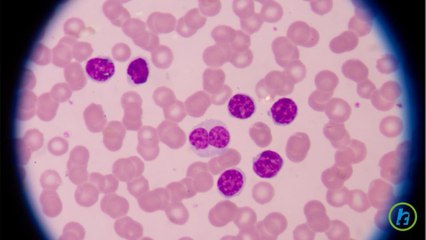What is Chronic Lymphocytic Leukemia?