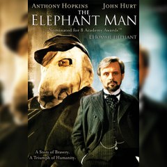 Elephant man