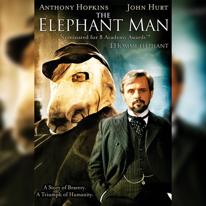 The Elephant Man