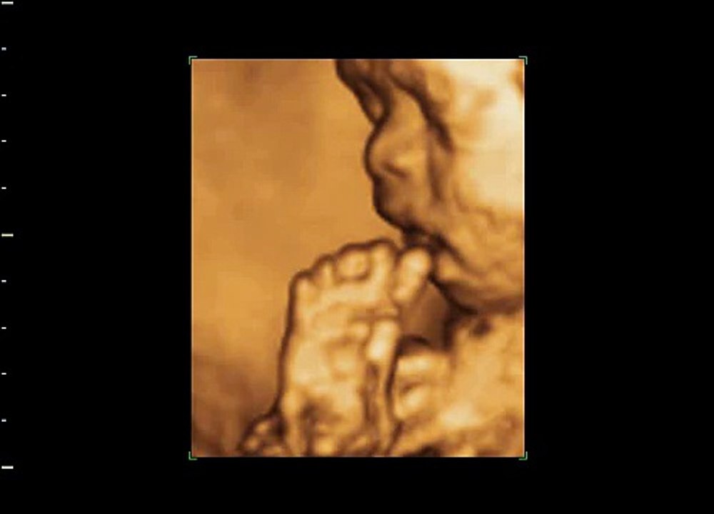 3D/4D Ultrasound BabyICON 28 weeks 玩腳 BB