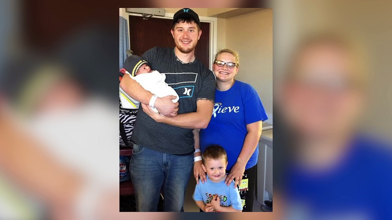 Miracle: Un bébé survit avec un cerveau hors de son crâne