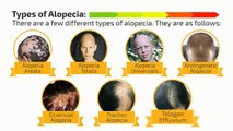 Alopecia - An Overview To The Severe Hair Loss Problem