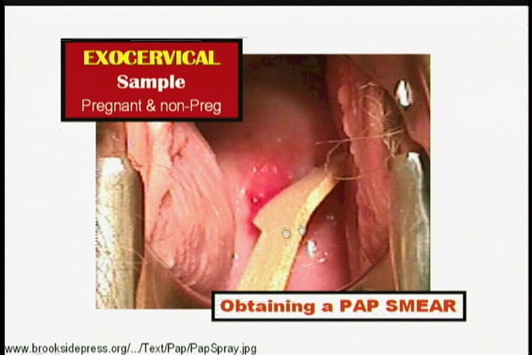 ch.01_03_Gynecologic Procedures