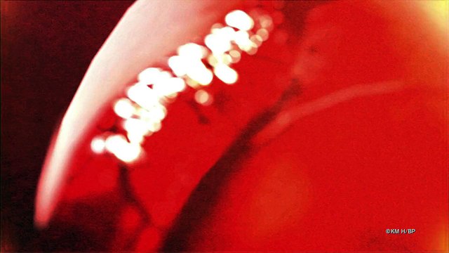 Berserk : Trailer de gameplay