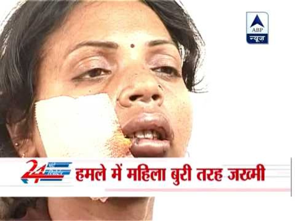 Delhi: Woman injured by bikers, blade man suspected