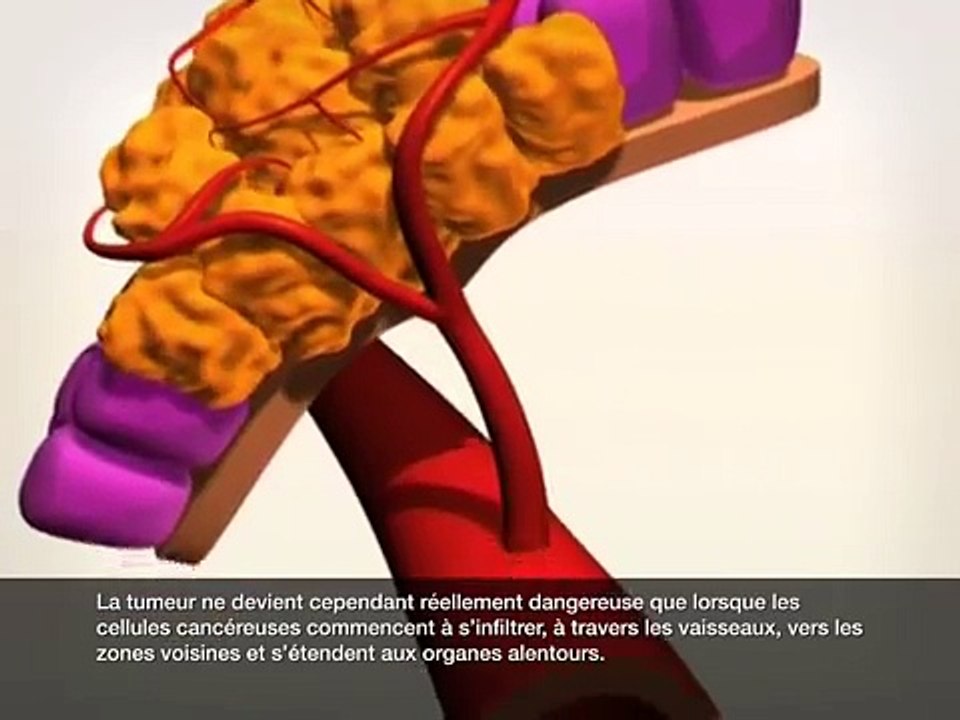 Le cancer - de la cellule saine à la cellule malade