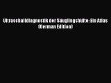 Read Book Ultraschalldiagnostik der SÃ¤uglingshÃ¼fte: Ein Atlas (German Edition) E-Book Free