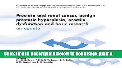 Read Prostate and Renal Cancer, Benign Prostatic Hyperplasia, Erectile Dysfunction and Basic