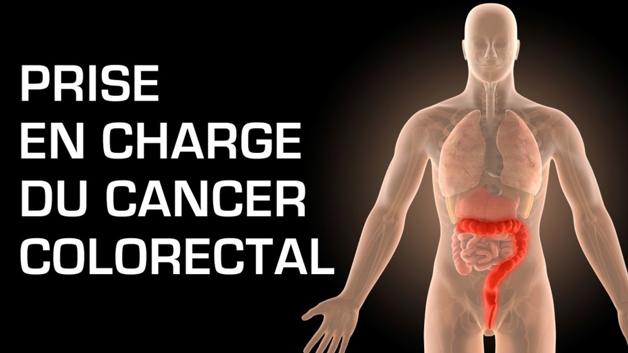 Prise en charge du cancer colorectal