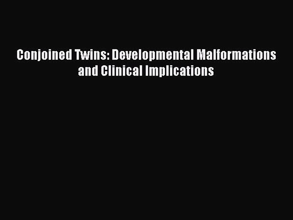 Read Conjoined Twins: Developmental Malformations and Clinical Implications Ebook Free