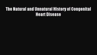 Download The Natural and Unnatural History of Congenital Heart Disease Ebook Online