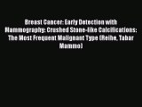 Read Book Breast Cancer: Early Detection with Mammography: Crushed Stone-like Calcifications: