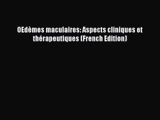 Read OEdÃ¨mes maculaires: Aspects cliniques et thÃ©rapeutiques (French Edition) Ebook Free
