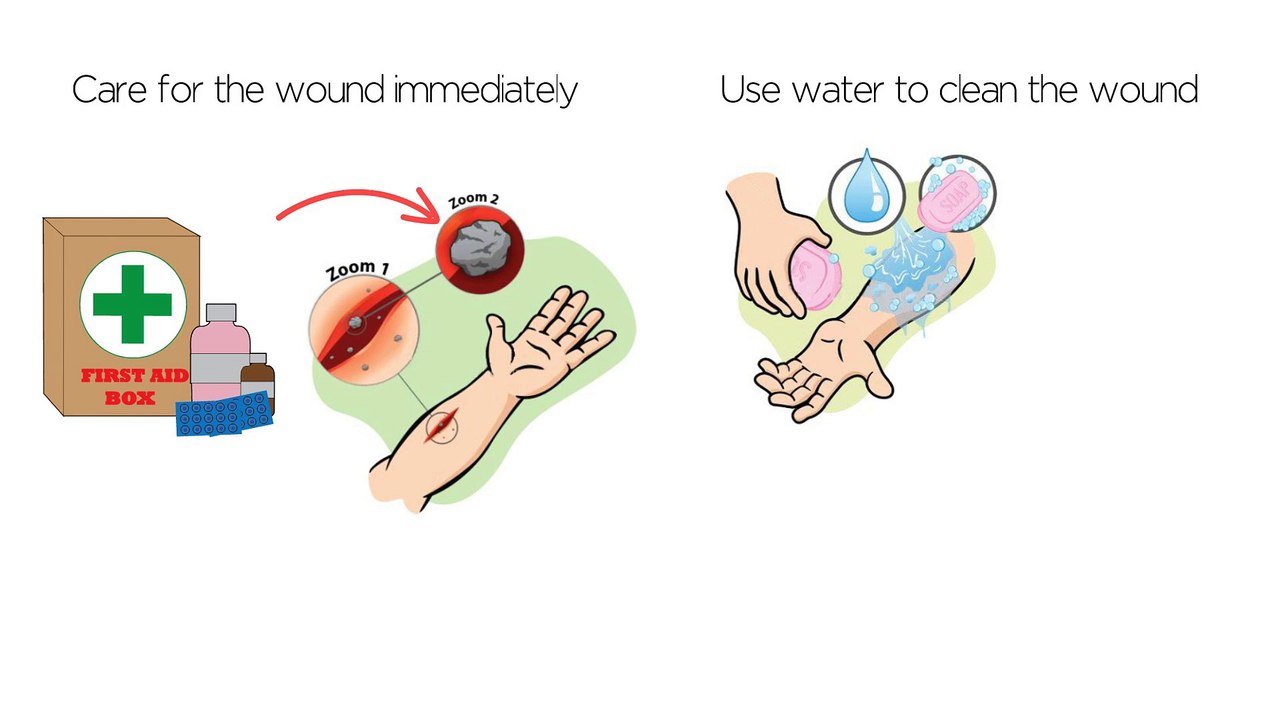 Wound Care – Tips On Dealing With Wounds