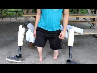 Amputee Gives Instructive Video in How His Legs and Feet Work