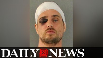 Would-Be Burglar In Florida Beaten With His Own Bat, Flees Bleeding