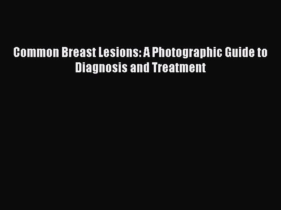 Read Books Common Breast Lesions: A Photographic Guide to Diagnosis and Treatment E-Book Free