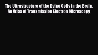 Read The Ultrastructure of the Dying Cells in the Brain. An Atlas of Transmission Electron