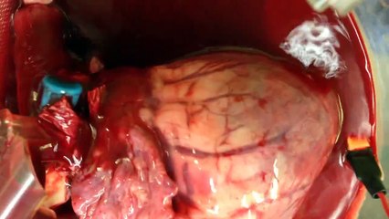 Heart stored in Somah for 24 hours prior to Resuscitation